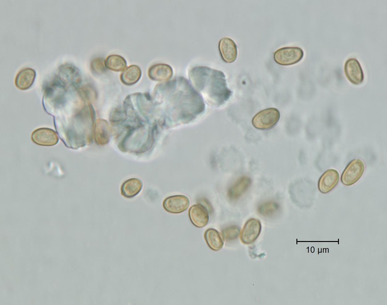 Pholiota squarrosa (Vahl) P. Kumm Figure 4